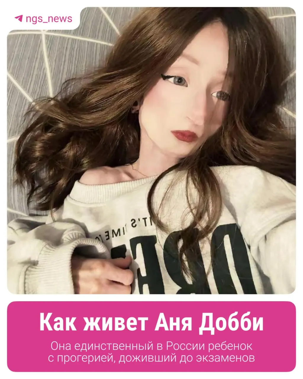 Ане почти 17 лет. Несмотря на редкое генетическое заболевание, она остаётся обычной подросткой. Семья ждёт участия в американских испытаниях лекарства и добивается получения школьного аттестата.