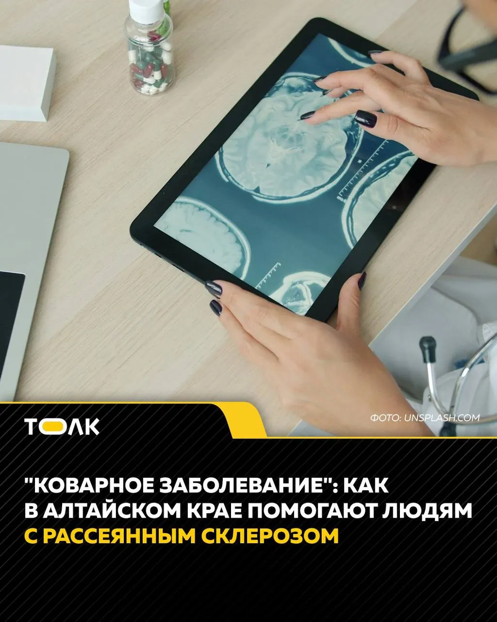 Рассеянный склероз встречается в основном у людей 20–40 лет и проявляется по‑разному. В Алтайском крае работает Школа рассеянного склероза, где проводят занятия по лечению, реабилитации и психологической поддержке.