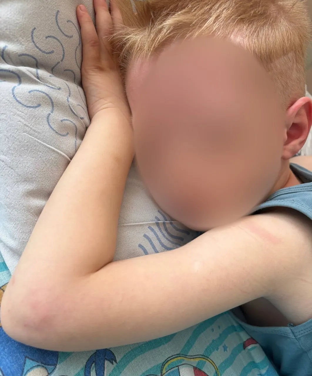 Четырёхлетний мальчик с аллергией на белок коровьего молока попал в больницу после того, как в детском саду ему дали мясной рулет с опасным для него компонентом. Родители требуют проверки.