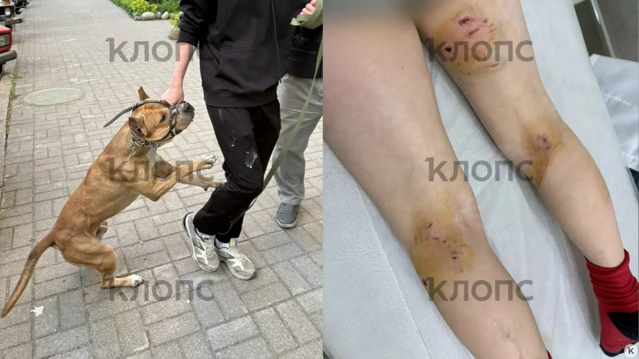 Собака гуляла без поводка и с повреждённым намордником; детям наложили швы и начали курс прививок от бешенства, владельцы животного пока не выходят на связь.