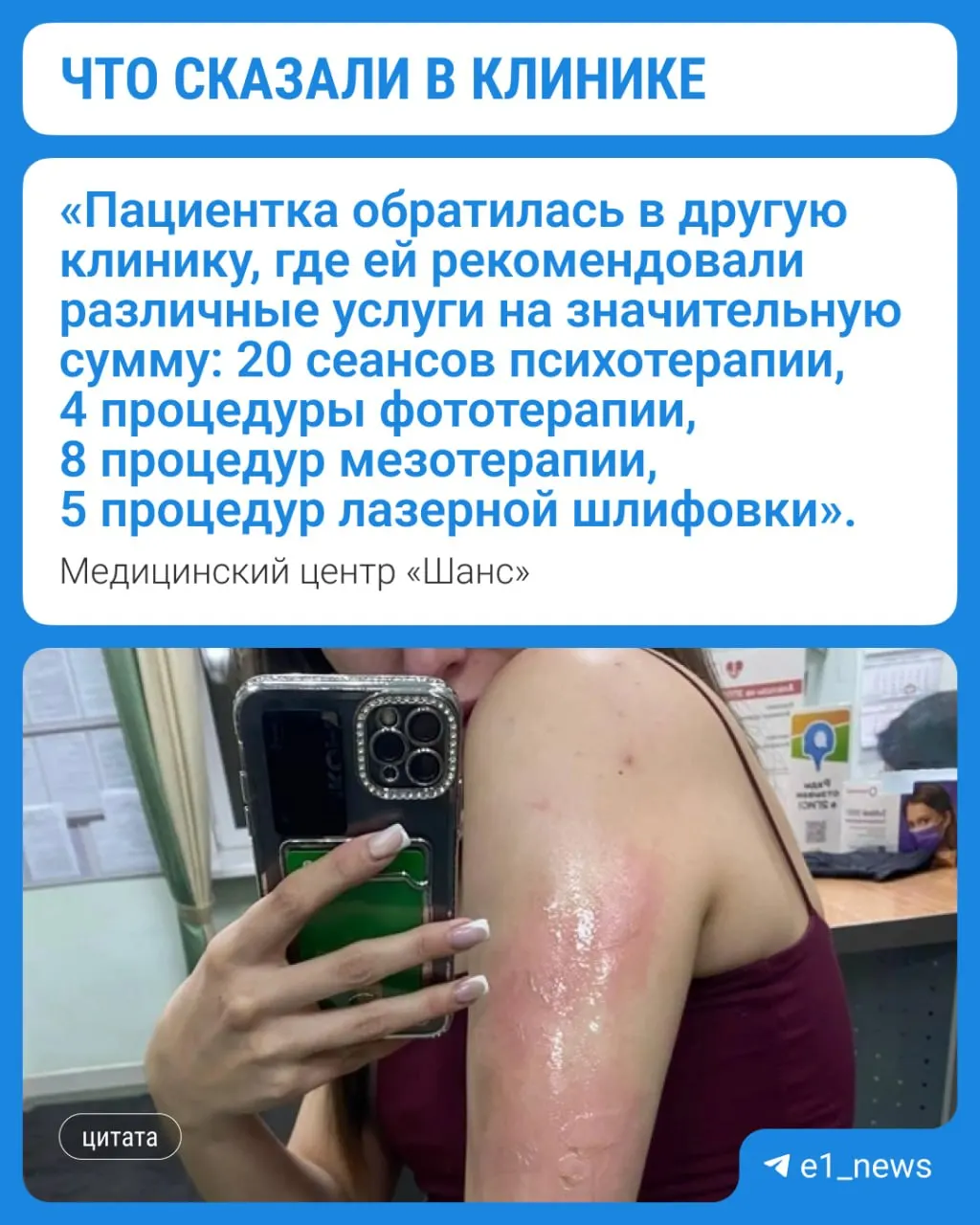 В клинике заявили, что пациентке стало плохо и её положили на кушетку, где она получила ожог от батареи. Врач сразу обработал рану, пациентке предлагали бесплатные услуги косметолога, но она отказалась; судмедэкспертиза пока не предоставлена.