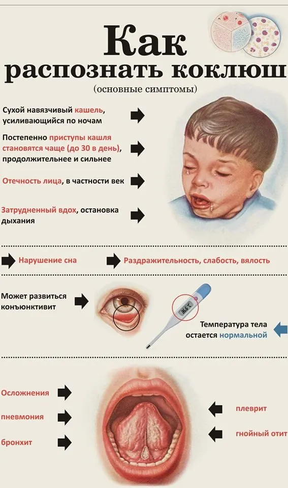 Медики отмечают всплеск случаев коклюша в регионе, особенно среди детей. Болезнь протекает тяжело, лечение может длиться несколько месяцев, поэтому специалисты напоминают о важности своевременной вакцинации.
