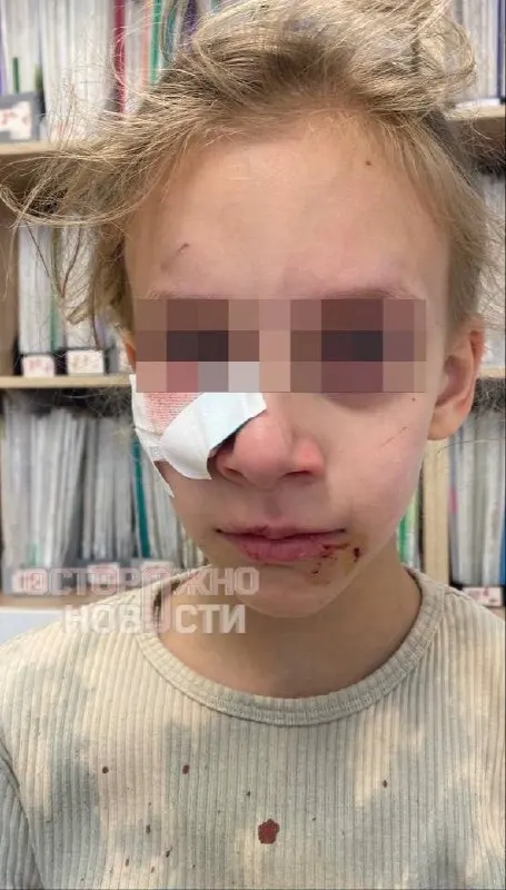 Во время прогулки в пришкольном летнем лагере пёс напал на восьмилетнюю ученицу. Девочке сделали операцию, полиция начала проверку; отец утверждает, что директор не сразу вызвал скорую и обвинил ребёнка.