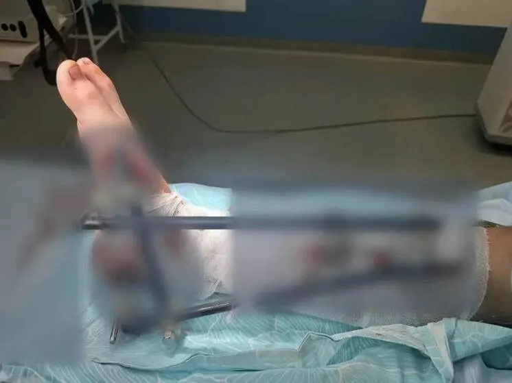 В ходе лечения врачи стабилизировали состояние пациента, затем провели реконструктивную операцию. Реабилитация может затянуться, но задача — сохранить функции конечности и вернуть мальчику полноценную жизнь.