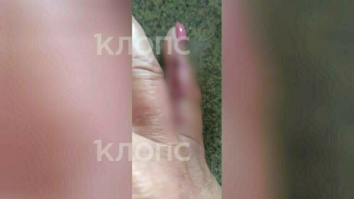 На перекрёстке Невского и Достоевского зафиксировано три случая укусов за час: женщины Марина и Ольга и мужчина получили травмы и обратились к медикам.