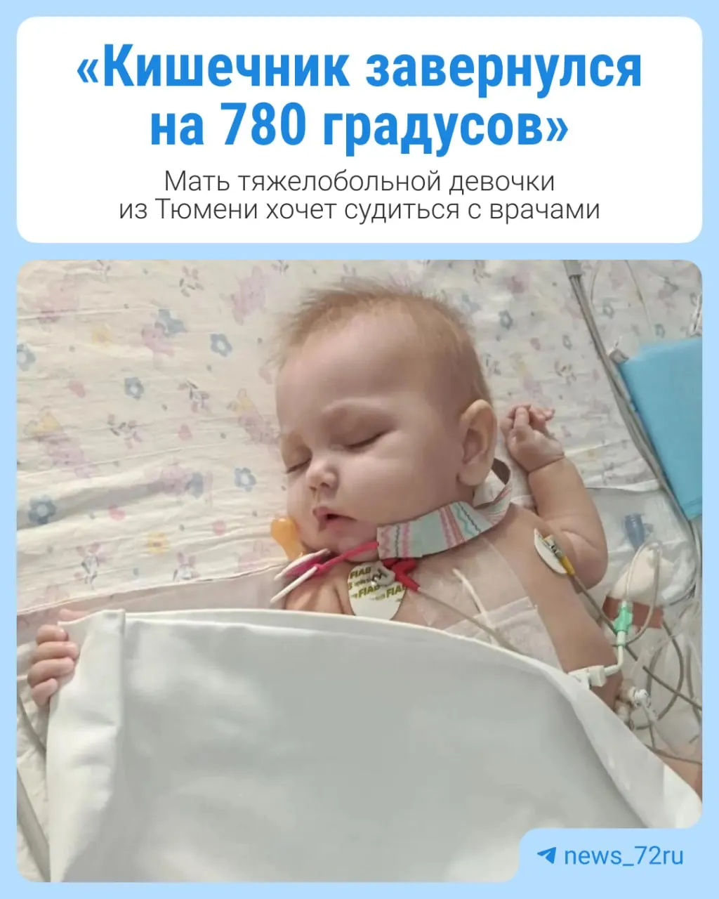 Женщина требует проверить качество и своевременность медицинской помощи после экстренной операции у Варвари Овчинниковой и провести перинатальный аудит произошедшего.