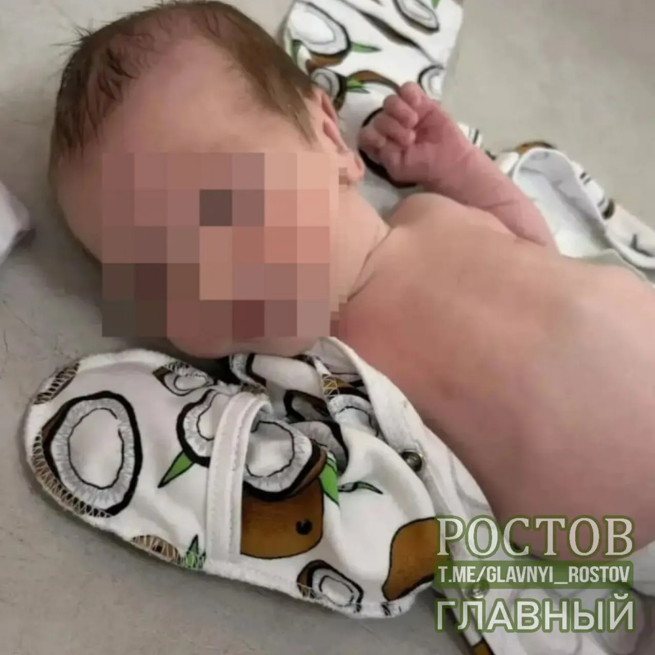 У плода была тяжелая анемия, врачам пришлось провести четыре переливания крови, беременность удалось сохранить до 36-й недели, и малыш весом 2700 г родился естественным путём.