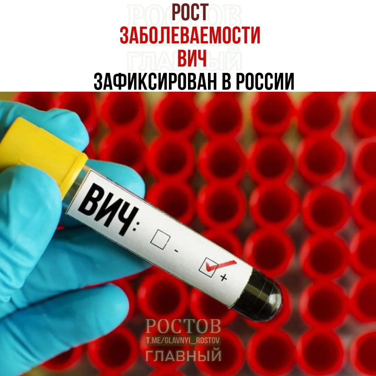 Новые данные о ситуации с ВИЧ в России: эпидемия охватила около 30 регионов, в 2025 году зафиксировано около 45 тысяч новых случаев, существует риск того, что более 600 тысяч человек остаются источниками инфекции из-за слабого контроля.