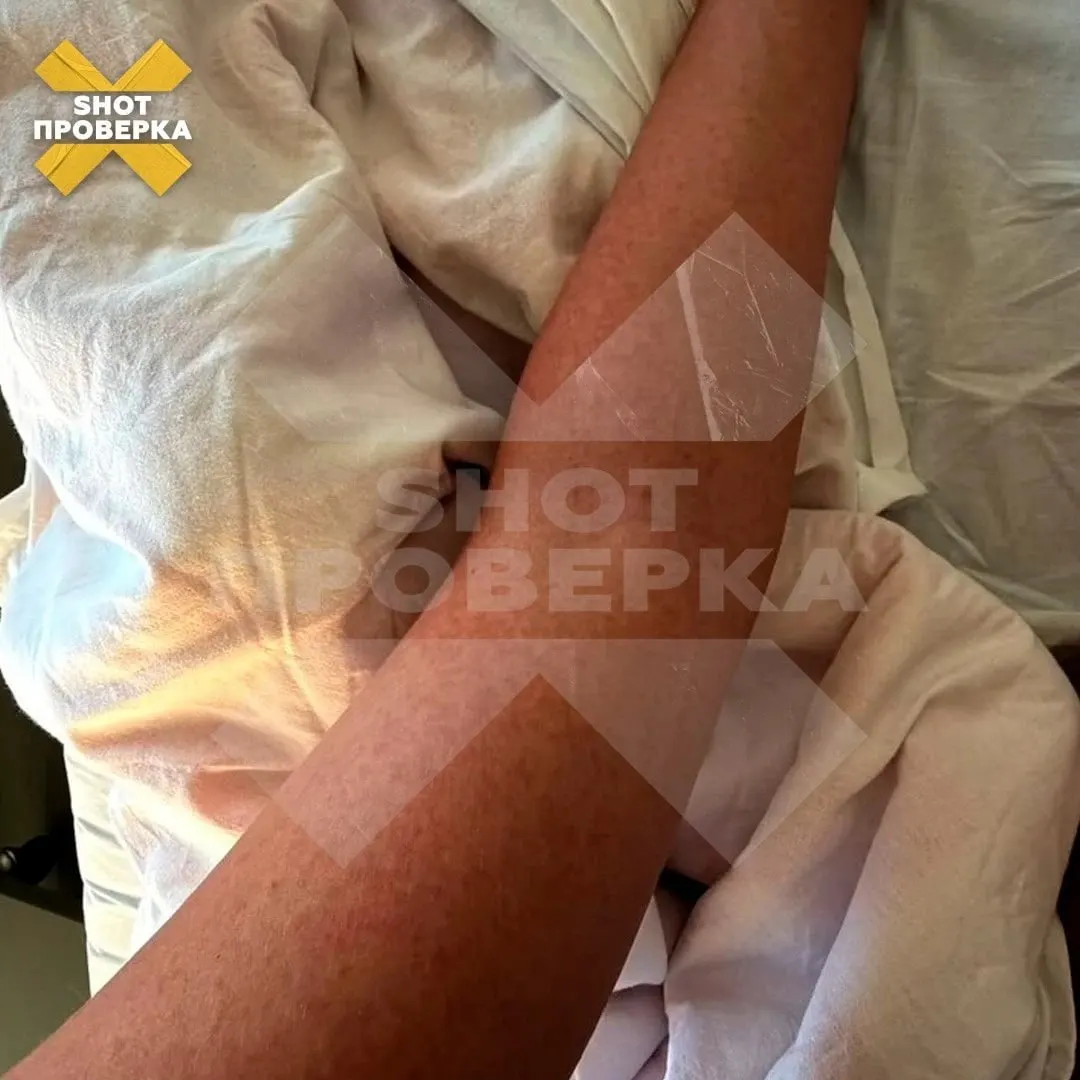 После поездки на Бали россиянке диагностирован вирус Зика; болезнь передается через укусы комаров и может быть опасной для беременных. В России зафиксированы завозные случаи; ситуацию контролируют врачи.