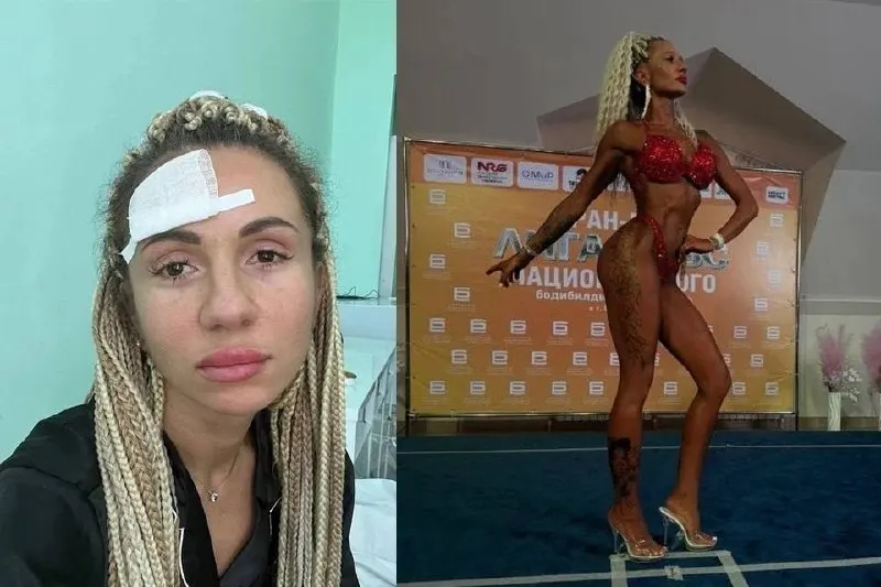 Оксана, мастер маникюра со стажем 13 лет, пережила химическое отравление, отслойку сетчатки и девять операций; преодолевая проблемы со здоровьем, она изменила жизнь и завоевала призовое место на соревнованиях по фитнес-бикини.