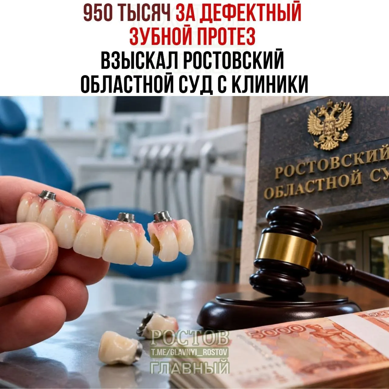 Мужчине установили четыре импланта и несъемный протез; спустя время выяснилось, что жевать нельзя, зубы выпадали. Суд обязал клинику возместить стоимость услуг, моральный вред, штраф и расходы.