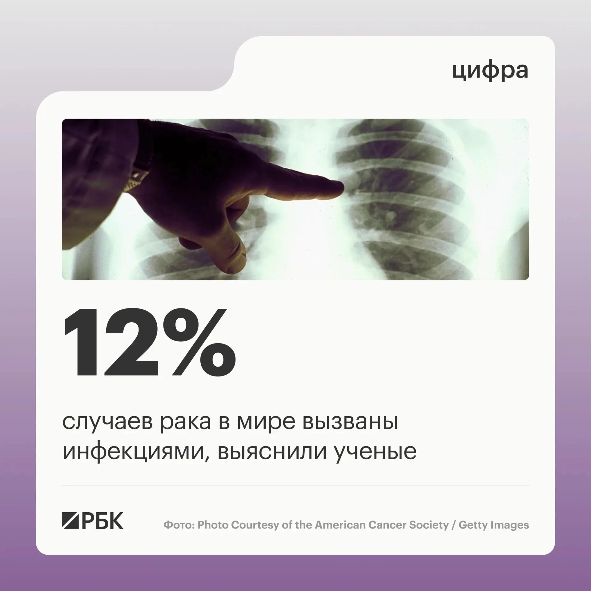 Новое исследование связывает раковые заболевания с инфекциями и описывает ведущие возбудители, а также варианты профилактики и лечения.