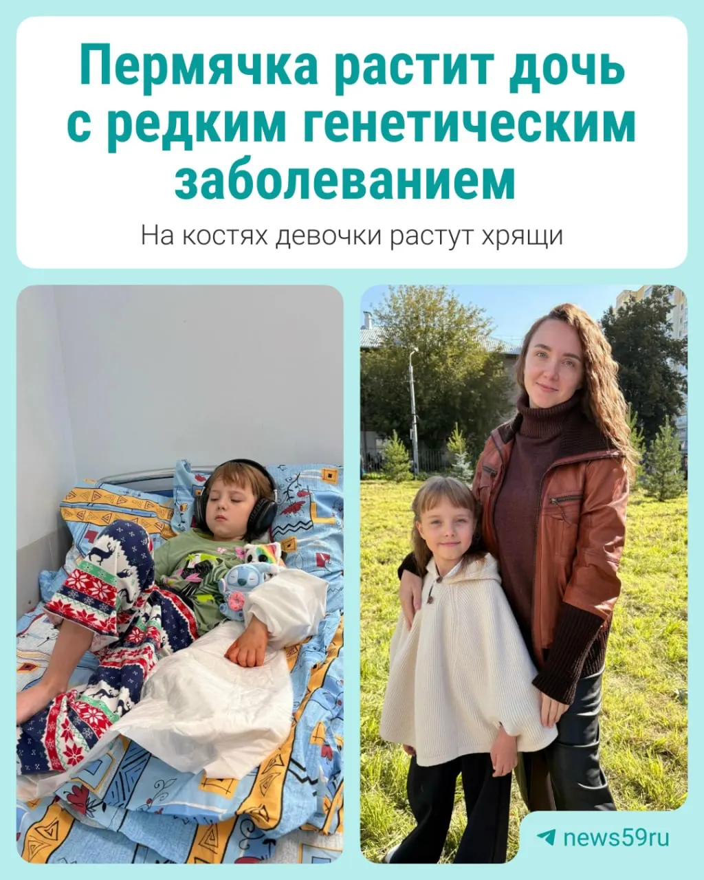 9-летняя София страдает редким заболеванием — экзостозной хондродисплазией. Родители ищут лечение, инвалидность и поддержку; в материале разбор ситуации и комментарий Минздрава Пермского края.