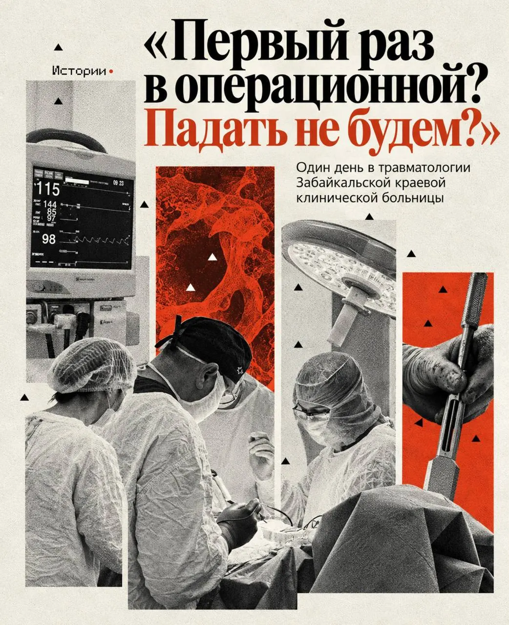 Как проходят операции по замене сустава: от подготовки до восстановления, в обычной рабочей смене медицинских специалистов.